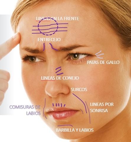 Linhas e Rugas de Expressão