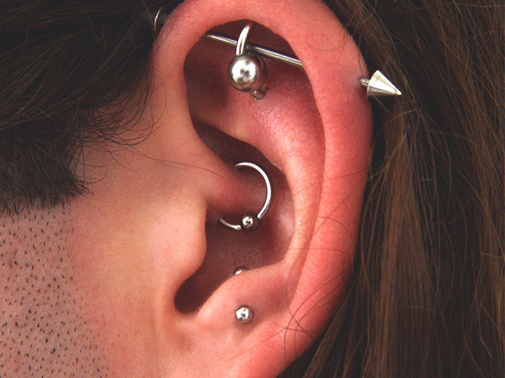 1033-Migraine_Piercings-732x549-thumbnail.jpg
